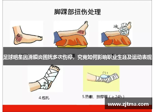 足球明星因滑膜炎困扰多次伤停，究竟如何影响职业生涯及运动表现